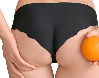 Alidya piel de naranja