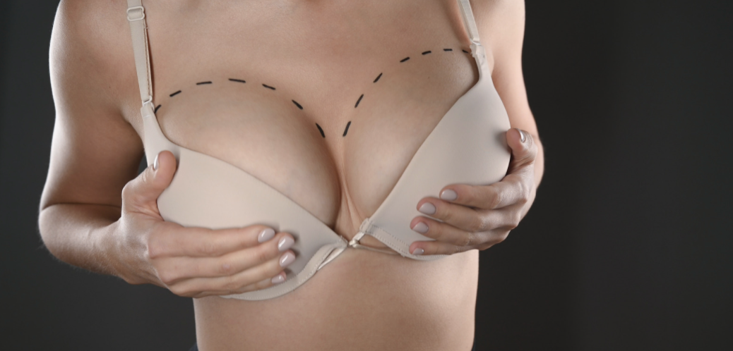 AUMENTO DE PECHO SUPERCHARGED (SILICONA + GRASA AUTÓLOGA)