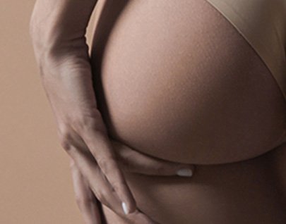 Aumento de gluteos por lipotransferencia