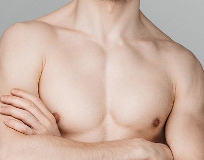 Ginecomastia