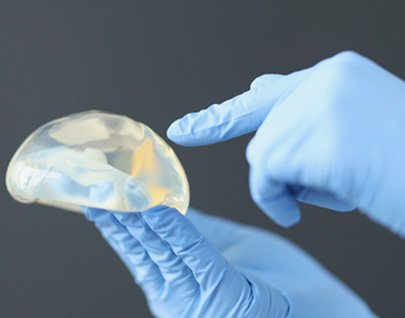 Retirada de implantes mamarios