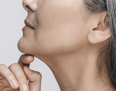 Liposucción de la papada