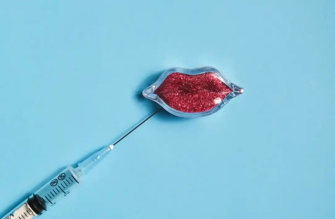 lo que debes saber sobre el aumento de labios con acido hialuronico