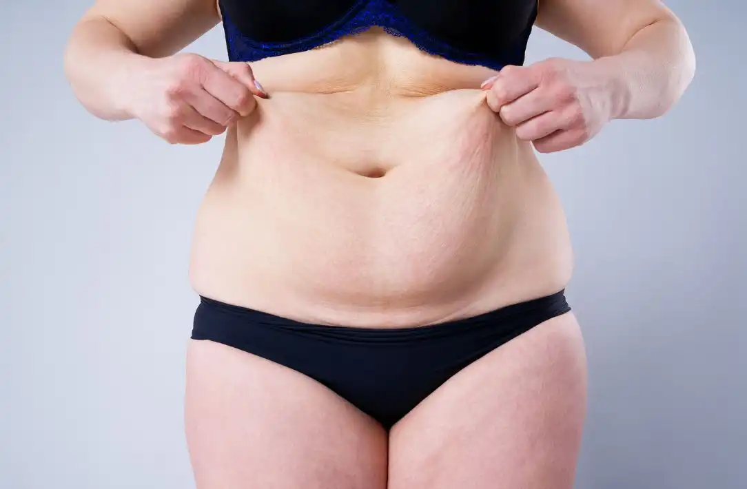 cuidados post operatorios en una abdominoplastia