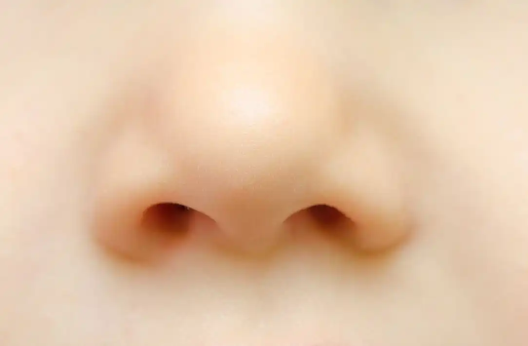 rinomodelacion sin cirugia como funciona