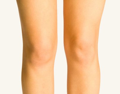 Tratamiento para Rejuvenecer las rodillas