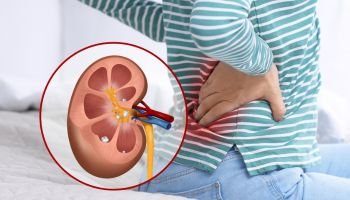 Consulta urólogo en Almería