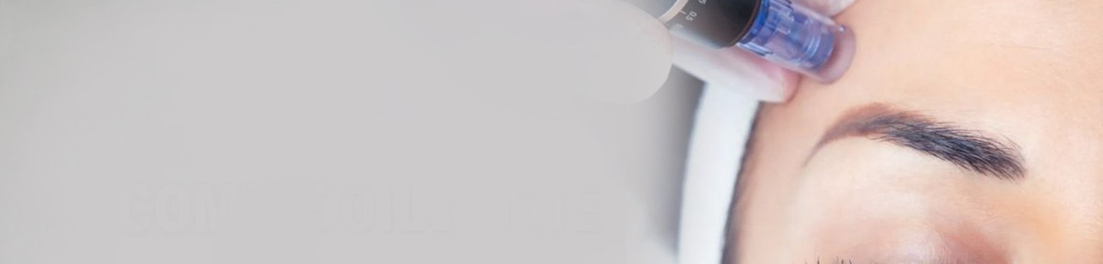 Tratamientos con Dermapen