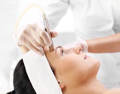 Microdermoabrasión con punta de diamante