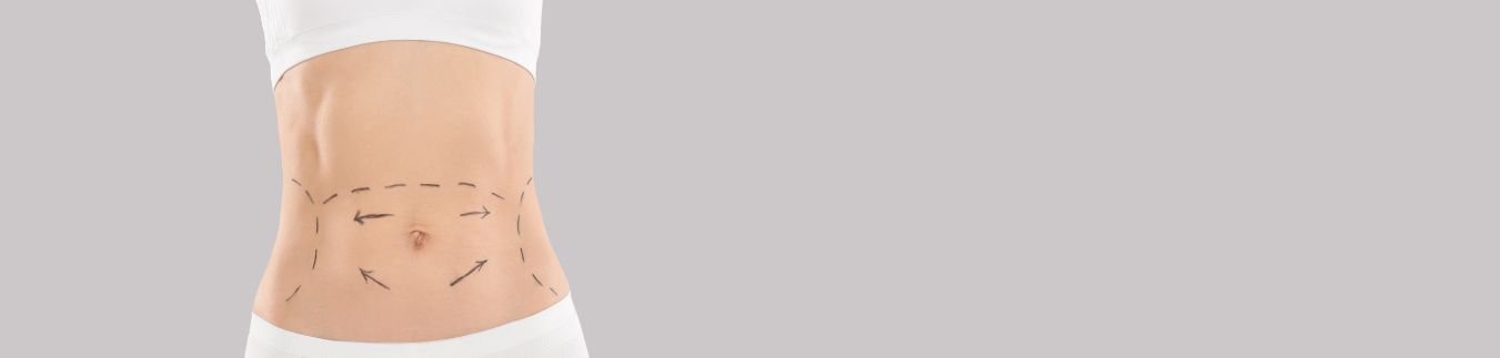 Abdominoplastia en Almería