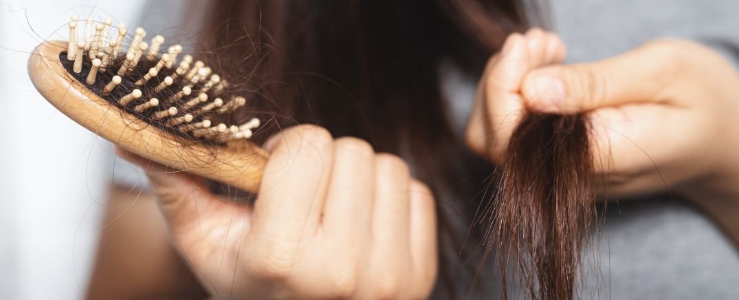 Mujer mostrando mechones de cabello en un cepillo, signo de ca&iacute;da capilar femenina y necesidad de tratamiento especializado.