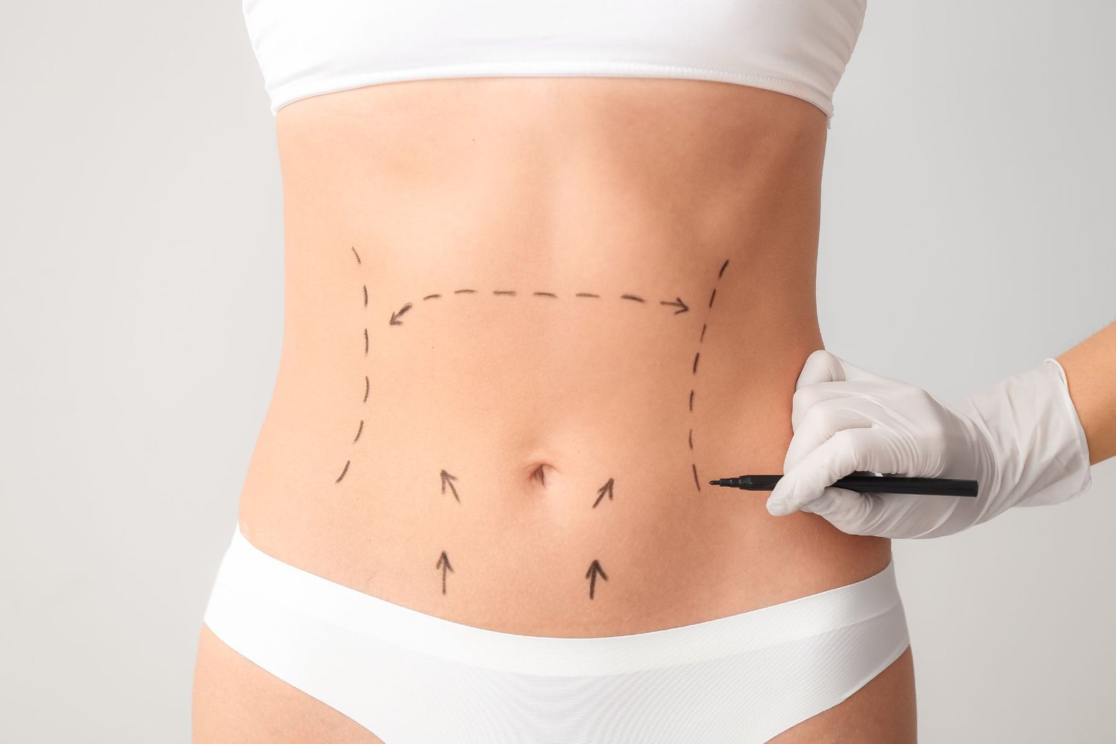 Precio de cirugia plástica 2025, liposucción