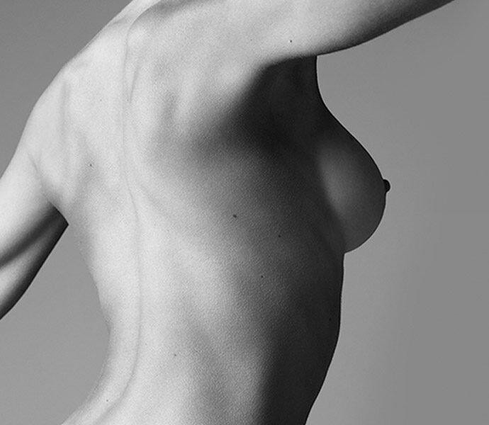 Aumento de pecho supercharged (implante + lipotransferencia)