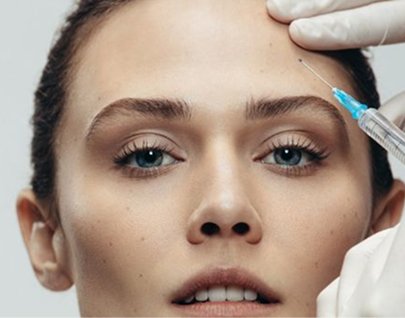 Arrugas de expresión